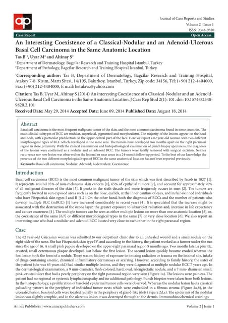 An interesting-coexistence-of-a-classical-nodular-and-an-adenoid-ulcerous-bas...