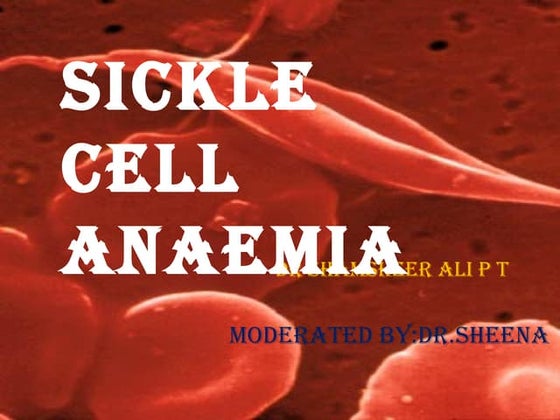 Sickle cell anemia
