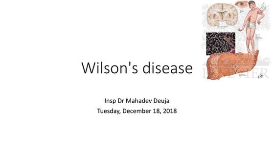 wilsons disease-18121814300767786654.pdf