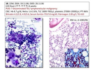 18. 22M, DOA: 19.11.06; DOD: 26.11.06
C/O fever (↑↑-↑↑↑) 4 weeks
PUO: ? Disseminated TB / lymphoreticular malignancy
CBC: Hb 8.7 g/dl, Retics 1.6-2.6%, TLC 1800-700/ l, platelets 27000-12000/ l; PTI 86%
Bilirubin 4.2/2.8, 4.9/3.6; Serum ferritin 7557.8 mg/dl; Fibrinogen 2.85 g/l; TG 410
BM no. A-1083/06
 