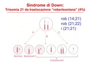 Sindrome di Down:
Trisomia 21 da traslocazione “robertsoniana” (4%)
rob (14;21)
rob (21;22)
i (21;21)
 