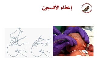 ‫إعطاء‬‫ا‬‫ألكسجين‬
 