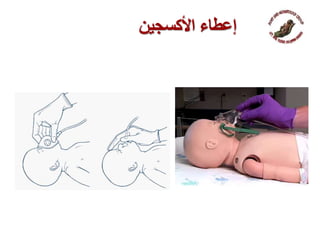 ‫إعطاء‬‫ا‬‫ألكسجين‬
 