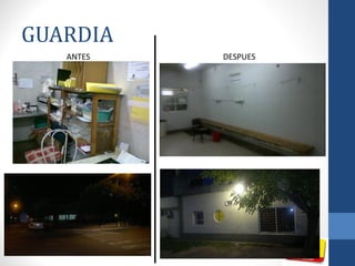 GUARDIA
ANTES DESPUES
 