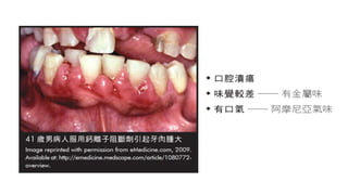 醫藥人 楊幽幽  腎病患者的口腔問題101