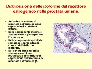 Distribuzione delle isoforme del recettore
estrogenico nella prostata umana.
• Ambedue le isofome di
recettore estrogenico sono
espresse nella prostata
umana.
• Nella componente stromale
sembra essere più espressa
l’isoforma α.
• Nella componente epiteliale
sembrano espressi livelli
comparabili delle due
isoforme.
• Nel cancro della prostata
sembra esserci una
progressiva diminuzione di
espressione dell’isoforma del
recettore estrogenico β.
 
