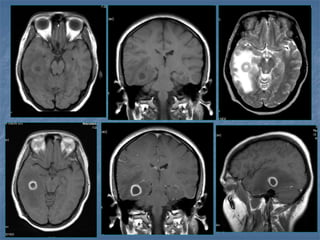 12 B. CT Brain.ppt