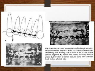 canted occlusal plane