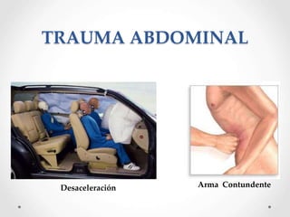 Desaceleración Arma Contundente
TRAUMA ABDOMINAL
 