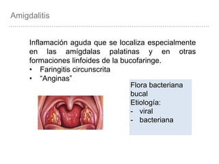 Inflamación aguda que se localiza especialmente
en las amígdalas palatinas y en otras
formaciones linfoides de la bucofaringe.
• Faringitis circunscrita
• “Anginas”
Flora bacteriana
bucal
Etiología:
- viral
- bacteriana
Amigdalitis
 