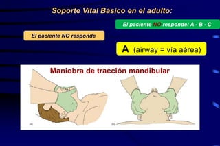 El paciente NO responde
A (airway = vía aérea)
Soporte Vital Básico en el adulto:
Maniobra de tracción mandibular
El paciente NO responde: A - B - C
 