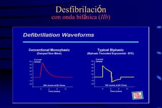 Desfibrilación
con onda bifásica (IIb)
IMAGEN DEL SITIO WEB DE LA COMPAÑÍA ZOLL
 