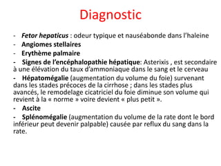 Diagnostic
- Fetor hepaticus : odeur typique et nauséabonde dans l’haleine
- Angiomes stellaires
- Erythème palmaire
- Signes de l’encéphalopathie hépatique: Asterixis , est secondaire
à une élévation du taux d’ammoniaque dans le sang et le cerveau
- Hépatomégalie (augmentation du volume du foie) survenant
dans les stades précoces de la cirrhose ; dans les stades plus
avancés, le remodelage cicatriciel du foie diminue son volume qui
revient à la « norme » voire devient « plus petit ».
- Ascite
- Splénomégalie (augmentation du volume de la rate dont le bord
inférieur peut devenir palpable) causée par reflux du sang dans la
rate.
 