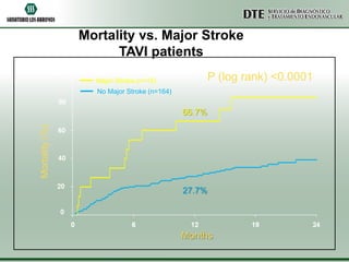 Mortality vs. Major Stroke
TAVI patients
P (log rank) <0.0001

Major Stroke (n=15)
No Major Stroke (n=164)

Mortality (%)

66.7%

27.7%

Months

 