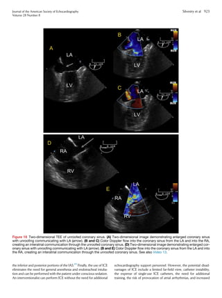 the inferior and posterior portions of the IAS.89
Finally, the use of ICE
eliminates the need for general anesthesia and endotracheal intuba-
tion and can be performed with the patient under conscious sedation.
An interventionalist can perform ICE without the need for additional
echocardiography support personnel. However, the potential disad-
vantages of ICE include a limited far-field view, catheter instability,
the expense of single-use ICE catheters, the need for additional
training, the risk of provocation of atrial arrhythmias, and increased
Figure 18 Two-dimensional TEE of unroofed coronary sinus. (A) Two-dimensional image demonstrating enlarged coronary sinus
with unroofing communicating with LA (arrow). (B and C) Color Doppler flow into the coronary sinus from the LA and into the RA,
creating an interatrial communication through the unroofed coronary sinus. (D) Two-dimensional image demonstrating enlarged cor-
onary sinus with unroofing communicating with LA (arrow). (B and E) Color Doppler flow into the coronary sinus from the LA and into
the RA, creating an interatrial communication through the unroofed coronary sinus. See also Video 13.
Journal of the American Society of Echocardiography
Volume 28 Number 8
Silvestry et al 923
 