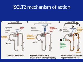 iSGLT2 mechanism of action
 