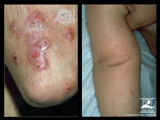 3. derma 1-ex