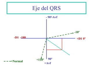 Eje del QRS -D1 +Avf 90º +D1 0º - 90º -Avf -180 -10º +110º =Normal 