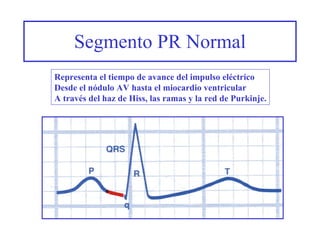 Segmento PR Normal Representa el tiempo de avance del impulso eléctrico Desde el nódulo AV hasta el miocardio ventricular A través del haz de Hiss, las ramas y la red de Purkinje. 