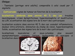 Clinique:
- Taeniasis: (portage vers adulte), comparable à celui causé par T.
saginata;
- Cysticercose: signes de tumeur en fonction de la localisation
localisations cérébrale dans environ 40 % des cas: troubles
neurologiques, crises épileptiformes, hyperéosinophilie et modification
du LCR, accentuation des signes lors de la mort des cysticerques
localisation oculaire dans environ 40 % des cas: exsudat inflammatoire,
douleur intra-orbitaire, diminution du champ de vision, hyperéosinophilie
faible, accentuation des signes lors de la mort des cysticerques
localisations    musculaires      et  sous-cutanées      plus   souvent
asymptomatiques: crampes, fatigue, tachycardie          et syncopes si
localisation dans le muscle cardiaque
 