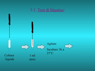 3.1.  Test di blastèse : Coltura liquida 1 ml siero Agitare Incubare 3h a 37°C 
