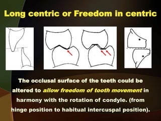 Long centric or Freedom in centric
The occlusal surface of the teeth could be
altered to allow freedom of tooth movement in
harmony with the rotation of condyle. (from
hinge position to habitual intercuspal position).
 