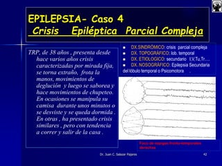 EPILEPSIA- Caso 4
Crisis Epiléptica Parcial Compleja
TRP, de 38 años , presenta desde
hace varios años crisis
caracterizadas por mirada fija,
se torna extraño, frota la
manos, movimientos de
deglución y luego se saborea y
hace movimientos de chupeteo.
En ocasiones se manipula su
camisa durante unos minutos o
se desviste y se queda dormida .
En otras , ha presentado crisis
similares , pero con tendencia
a correr y salir de la casa .
Dr. Juan C. Salazar Pajares 42
Foco de espigas fronto-temporales
derechas
 DX.SINDRÓMICO: crisis parcial compleja
 DX. TOPOGRÁFICO: lob. temporal
 DX. ETIOLOGICO: secundario I,V,Tu,Tr….
 DX. NOSOGRÁFICO: Epilepsia Secundaria
del lóbulo temporal o Psicomotora .
 