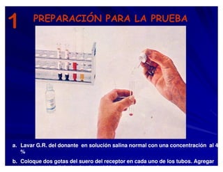 1 PREPARACIÓN PARA LA PRUEBA
a. Lavar G.R. del donante en solución salina normal con una concentración al 4
%
b. Coloque dos gotas del suero del receptor en cada uno de los tubos. Agregar
tres gotas de albúmina bovina al 22 % a uno de los tubos
 