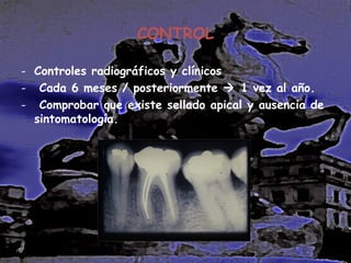 CONTROL
- Controles radiográficos y clínicos
- Cada 6 meses / posteriormente  1 vez al año.
- Comprobar que existe sellado apical y ausencia de
sintomatología.

 