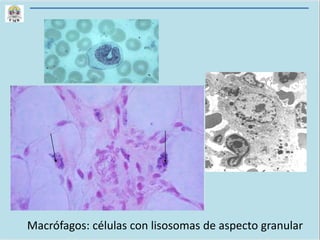 Macrófagos: células con lisosomas de aspecto granular
 