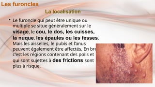 La localisation
• Le furoncle qui peut être unique ou
multiple se situe généralement sur le
visage, le cou, le dos, les cuisses,
la nuque, les épaules ou les fesses.
Mais les aisselles, le pubis et l’anus
peuvent également être affectés. En bref
c'est les régions contenant des poils et
qui sont sujettes à des frictions sont
plus à risque.
Les furoncles
 
