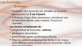 Evolution
• L’évolution des furoncles est variable. Le furoncle
peut avorter en 3 ou 4 jours.
• A l’inverse, il peut être volumineux, entraînant une
température élevée, avec malaise, frissons et
céphalée.
Les formes compliquées de :
• conglomérat de furoncles : anthrax ;
• abcédation secondaire ;
• présence de signes systémiques (fièvre).
• Chez les patients présentant les facteurs de risque,
cette affection peut évoluer vers la chronicité, c’est-à-
Les furoncles
 