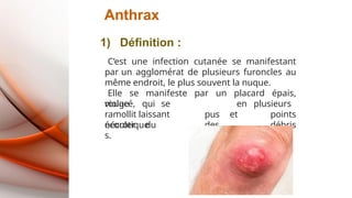 Anthrax
violacé, qui se
ramollit laissant
écouler du
pus et
des
en plusieurs
points
débris
nécrotique
s.
1) Définition :
C’est une infection cutanée se manifestant
par un agglomérat de plusieurs furoncles au
même endroit, le plus souvent la nuque.
Elle se manifeste par un placard épais,
rouge
 