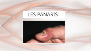 LES PANARIS
 