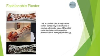 Fashionable Plaster Medical
This 3D-printed cast to help repair
broken bones may be the future of
medical orthopedic casts. 3D-printed
casts also bring out the positive
potential of this emerging technology.
 