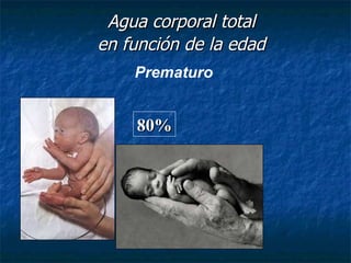Agua corporal total en función de la edad 80% Prematuro 