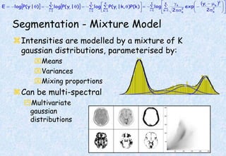 Segmentation - Mixture Model
Intensities are modelled by a mixture of K
gaussian distributions, parameterised by:
Means
Variances
Mixing proportions
Can be multi-spectral
Multivariate
gaussian
distributions
 