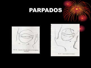 PARPADOS
 