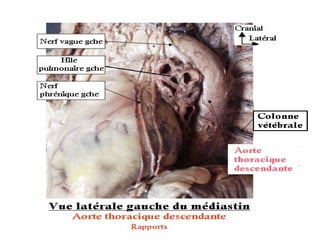 Anatomie du mediastin