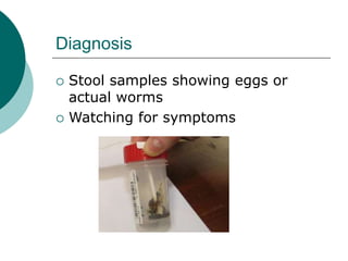 Diagnosis
 Stool samples showing eggs or
actual worms
 Watching for symptoms
 