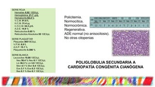 SERIE ROJA
Hematíes 6.92 10E6/μL
Hemoglobina 21.7 g/dL
Hematocrito 63.4 %
V.C.M. 91.6 fL
H.C,M. 31.4 pg
C.H.C.M. 34.3 g/dL
A.D.E. 14.9 %
Reticulocitos 0.65 %
Reticulocitos Absolutos 55 10E3/μL
SERIE PLAQUETAR
Plaquetas 36510E3/μL
V.P.M. 8.9 fL
A.D.P. 15.1 %
Plaquetocrito 0.398 %
SERIE BLANCA
Leucocitos 10.80 10E3/μL
Neu 56.4 % Neu 6.1 10E3/μL
Lin 36.3 % Lin 3.9 10E3/μL
Mon 4.1 % Mon 0.4 10E3/μL
Eos 3.1 % Eos 0.3 10E3/μL
Bas 0.1 % Bas 0.1 10E3/μL
Policitemia.
Normocítica.
Normocrómica.
Regenerativa.
ADE normal (no anisocitosis).
No otras citopenias
POLIGLOBULIA SECUNDARIA A
CARDIOPATÍA CONGÉNITA CIANÓGENA
 