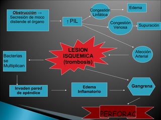 Obstrucción  -> Secresión de moco distiende el órgano ↑  PIL Congestión Venosa Afección Arterial LESION ISQUEMICA (trombosis) Bacterias se Multiplican Invaden pared de apéndice Edema Inflamatorio Gangrena PERFORACIÓN Congestión Linfática Edema Supuración 
