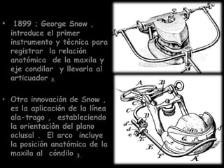 • 1899 ; George Snow ,
  introduce el primer
  instrumento y técnica para
  registrar la relación
  anatómica de la maxila y
  eje condilar y llevarla al
  articuador 3.

• Otra innovación de Snow ,
  es la aplicación de la línea
  ala-trago , estableciendo
  la orientación del plano
  oclusal . El arco incluye
  la posición anatómica de la
  maxila al cóndilo 3.
 