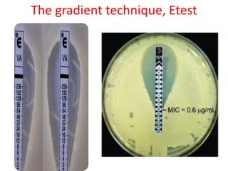 The gradient technique, Etest
 