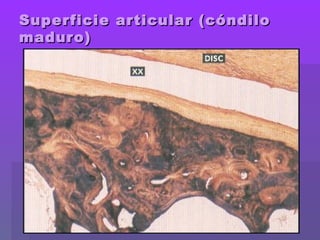 Superficie articular (cóndiloSuperficie articular (cóndilo
maduro)maduro)
 