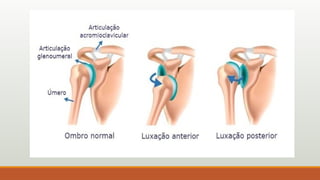 AULA 6 ANATOMIA SISTEMA ARTICULAR.pptxdd