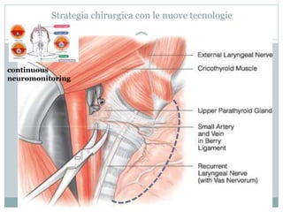 Strategia chirurgica con le nuove tecnologie
continuous
neuromonitoring
 