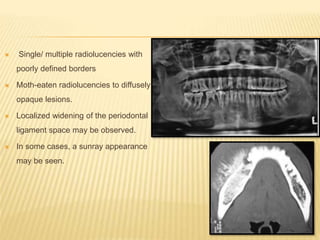  Single/ multiple radiolucencies with
poorly defined borders
 Moth-eaten radiolucencies to diffusely
opaque lesions.
 Localized widening of the periodontal
ligament space may be observed.
 In some cases, a sunray appearance
may be seen.
 