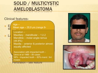 SOLID / MULTICYSTIC
AMELOBLASTOMA
Clinical features-
 Early stages – no clinical
signs
 Later –
 Facial deformity – swelling
(bony hard & bulky)
 Loosening of teeth
 Fractures
 Pain – less frequent
(pressure on nerves, sec.
infection)
 Large tumors – thinning of
cortices (egg shell crackling)
 Perforation – late feature
Age –
Mean age – 35.9 yrs (range 9-
92yrs)
Maxillary tumours – 47 yrs
Mandibular tumours – 35.2 yrs
Sex distribution –
Male : female – 1.1 : 1
Reichart et al 1995, biological profile of 3677
cases of ameloblastoma
 