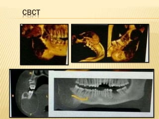 CBCT
 